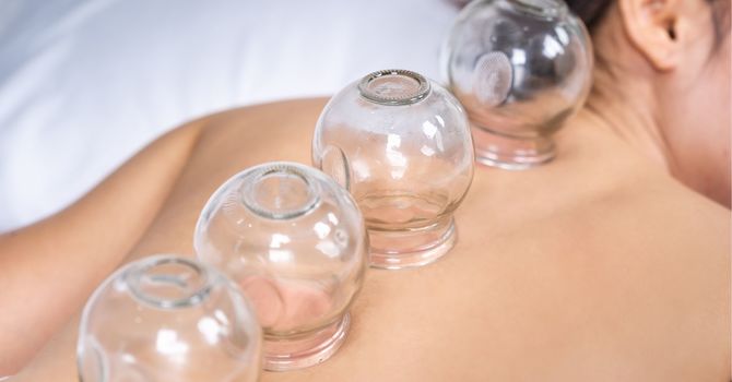 Chinese Herbal Medicine